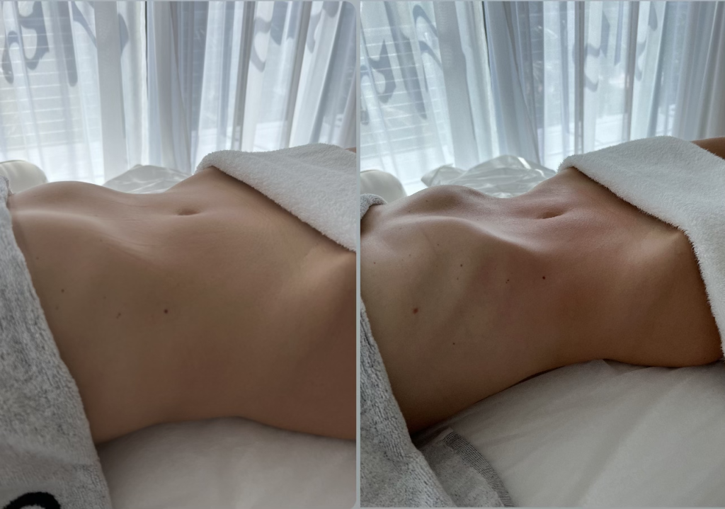 Can You Massage Away Stomach Fat? The Do's and Don'ts of Massage